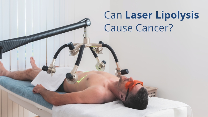 Can Laser Lipo Cause Cancer