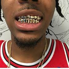 How Long Does Permanent Gold Teeth Last