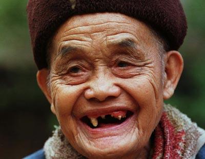 Is it Better to Smile With Teeth or Without