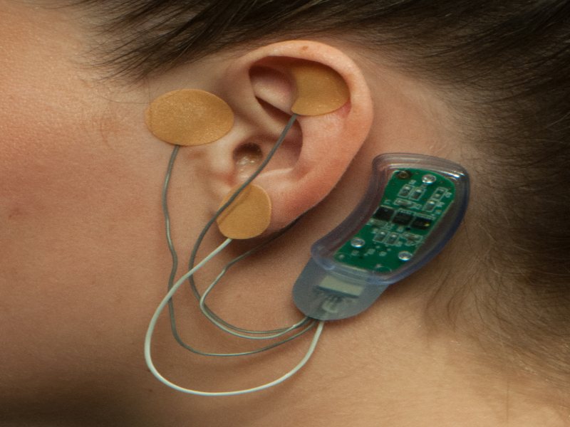 Behind The Ear Wearable Device For Opioid Treatment