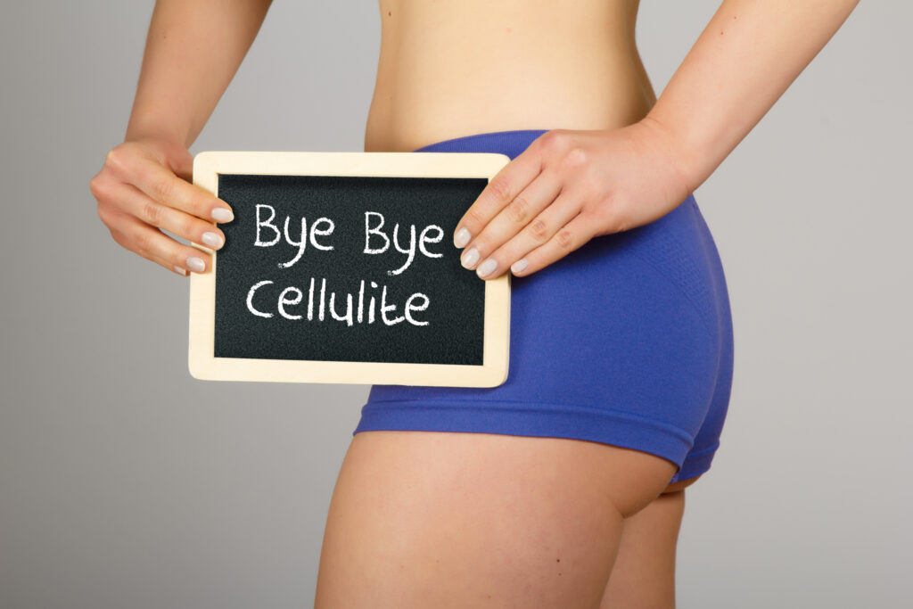 Does QWO Really Work For Cellulite