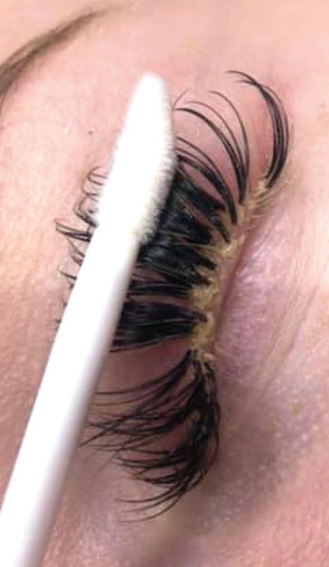 How do you treat blepharitis from eyelash extensions