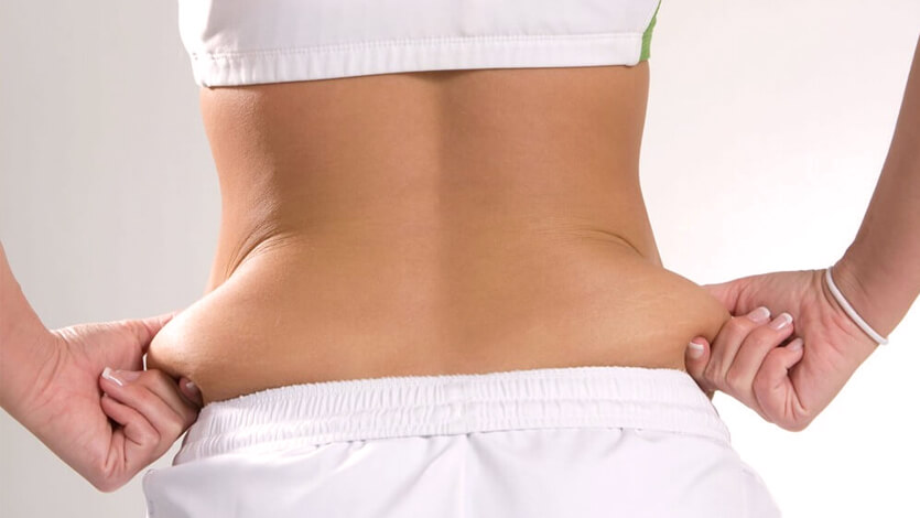 Is Liposuction Good For Love Handle Liposuction