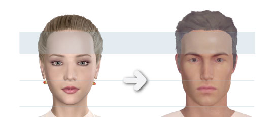 Is There Facial Masculinization Surgery