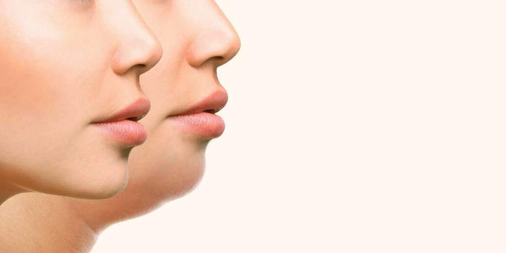 How Can I Reduce My Face Fat