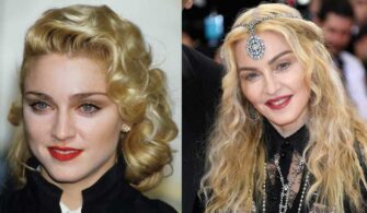 Madonna Face Lift