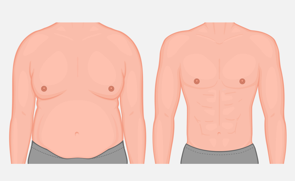 How do I know if its gyno or fat?
