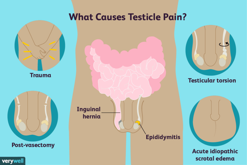 What Causes Testicular Pain?