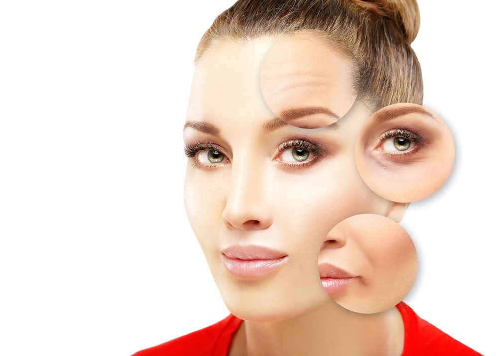 What areas is Botox best for