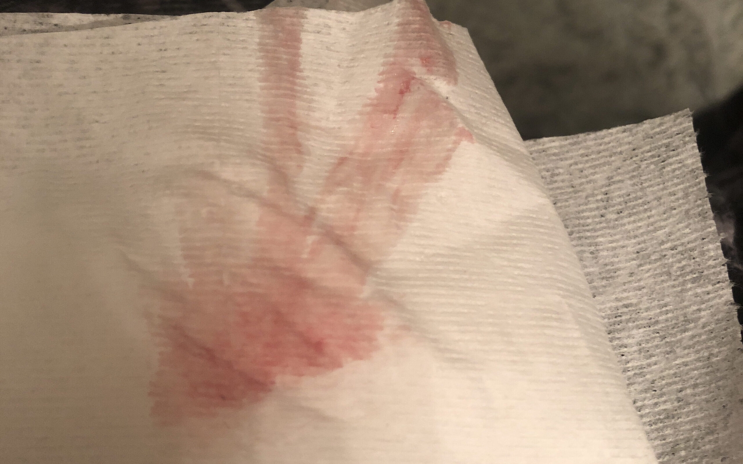 What does UTI bleeding look like