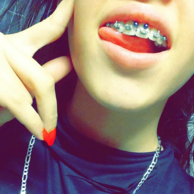 Do smiley piercings hurt your teeth