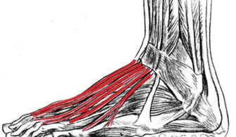 How do you treat extensor tendonitis in the foot?