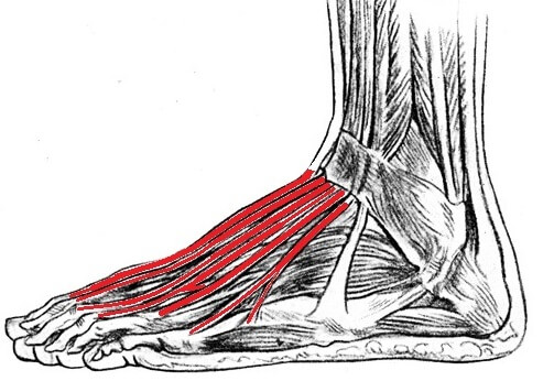 How do you treat extensor tendonitis in the foot?