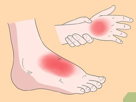 What is the fastest way to get rid of extensor tendonitis