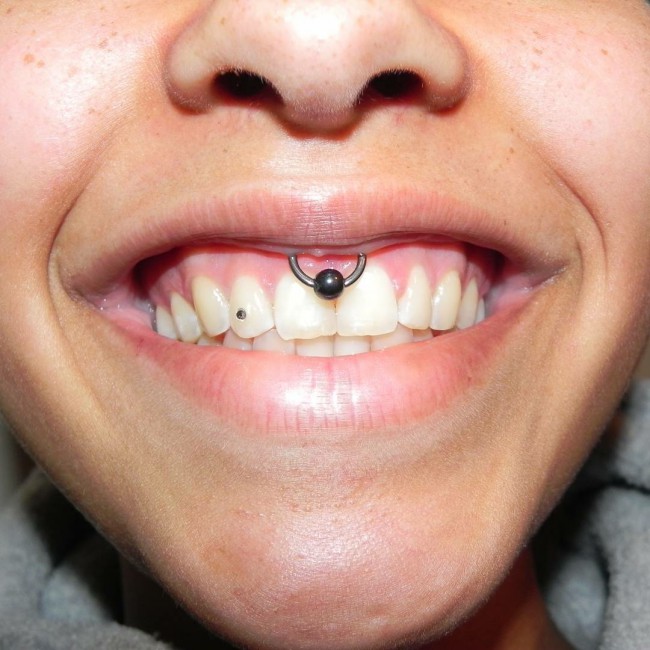 How long does smiley piercings last