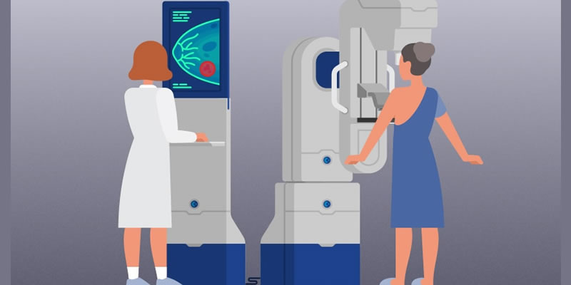 What is screening mammogram for malignant neoplasm of breast