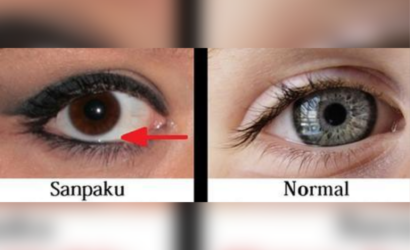 Sanpaku Eyes Curse