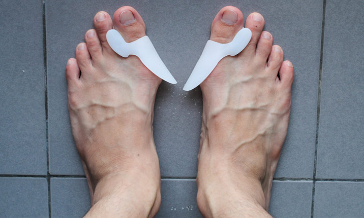 What is the most effective bunion surgery