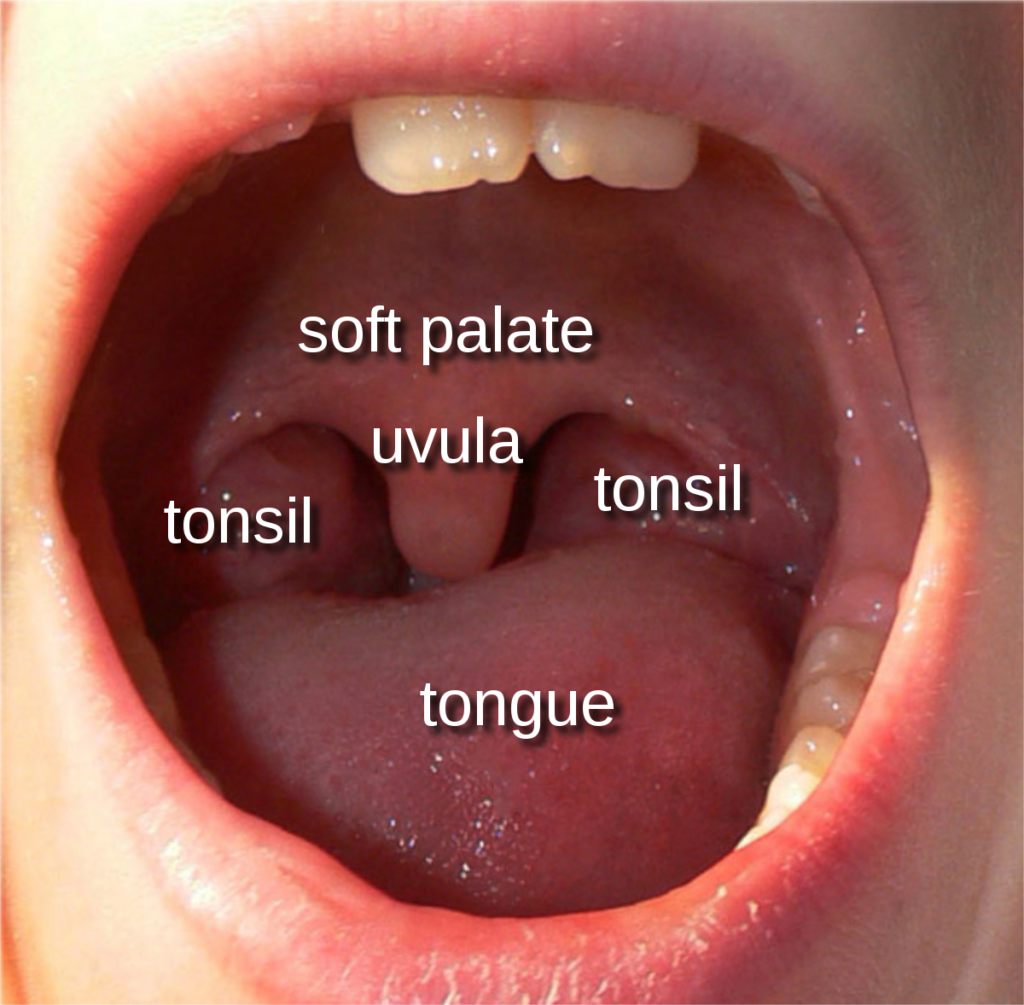Is uvula the same as tonsils