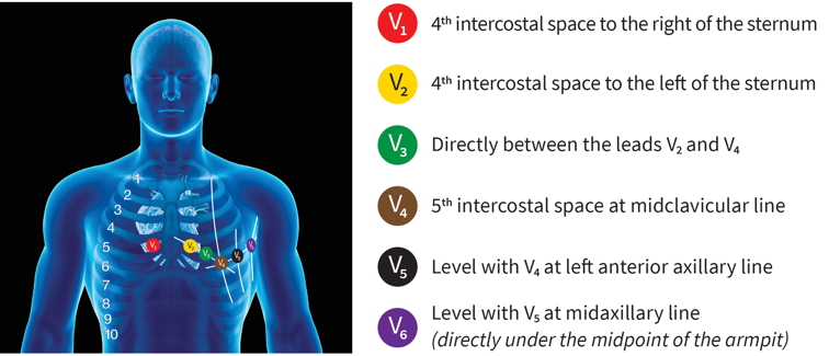 How many electrodes are on an ECG