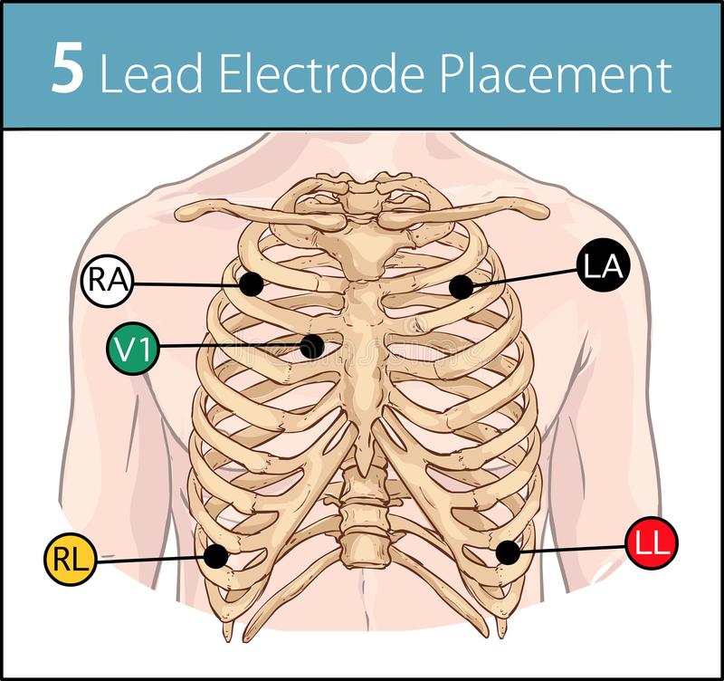 What is 5 lead ECG used for