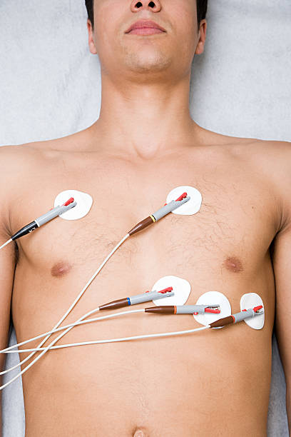 What are ECG electrodes