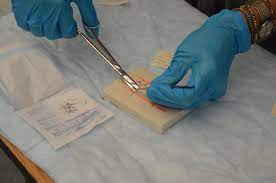 What is suture removal procedure
