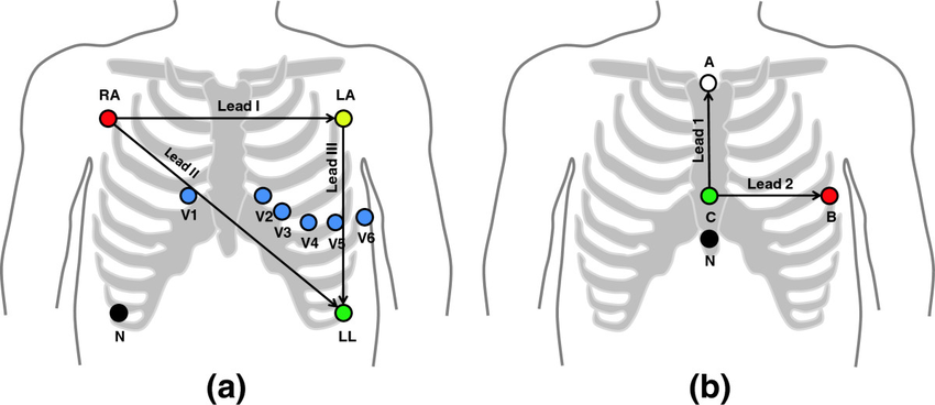 Why is a 12 lead ECG used
