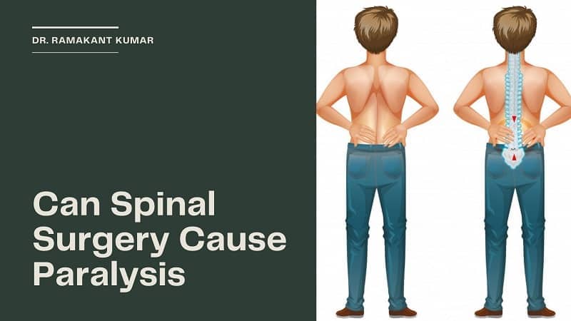 How common is paralysis after back surgery