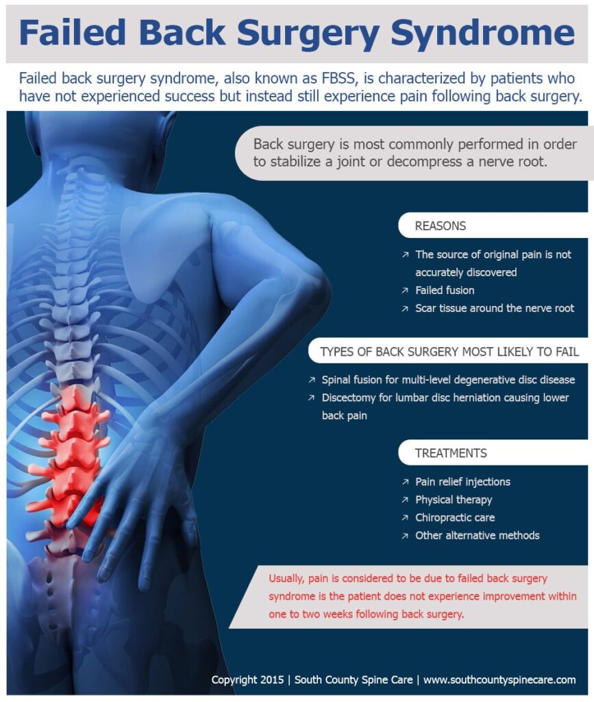 Leg Paralysis After Back Surgery