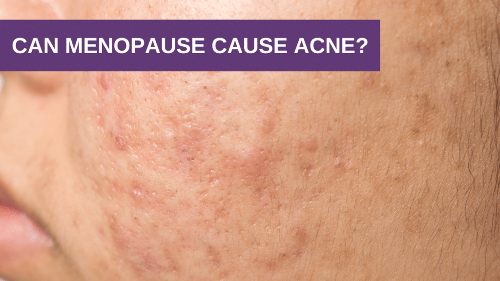 Can menopause cause acne breakouts