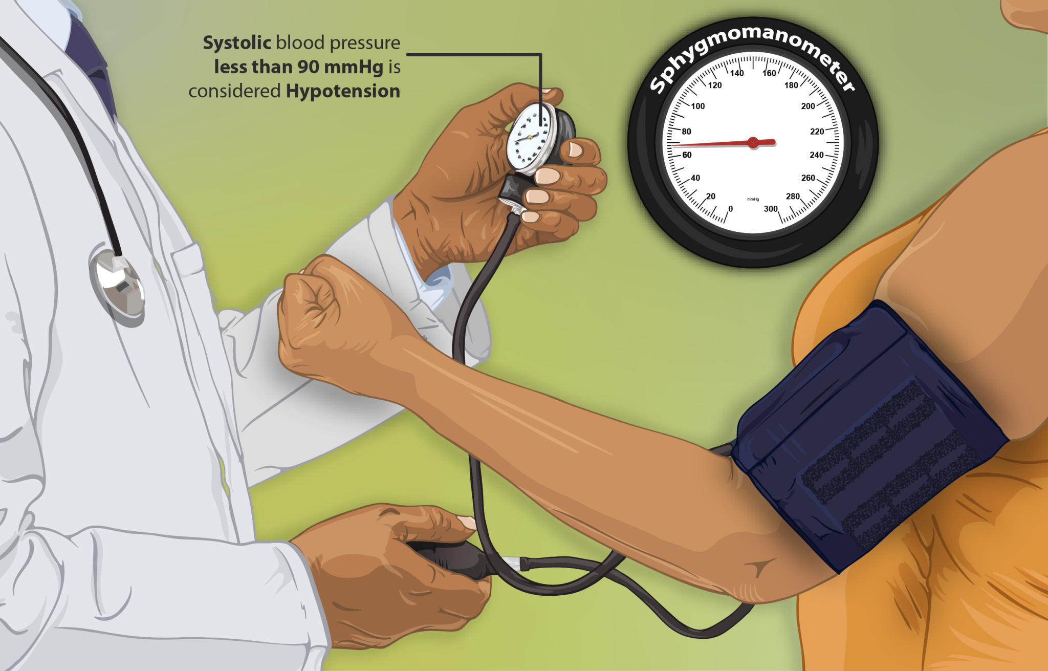 Exertional Hypotension
