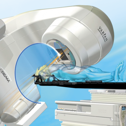 What size tumor can CyberKnife treat