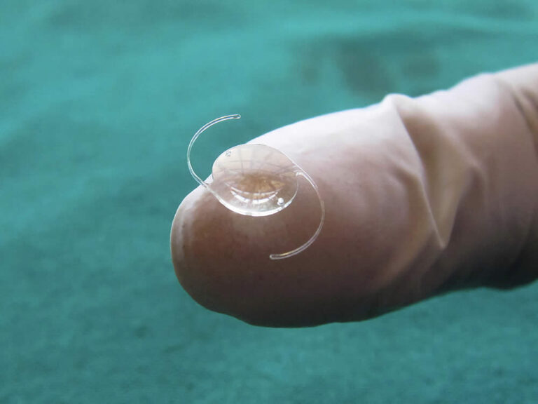 Types Of Cataract Surgery Lenses