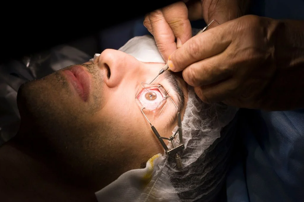 Eye Surgery LASIK