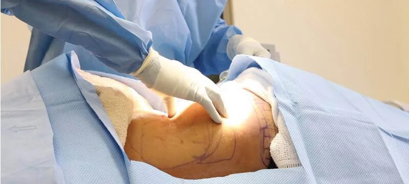 Titahi Bay Surgery