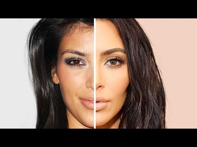 Kardashians Before Surgery