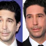 David Schwimmer and the Plastic Surgery